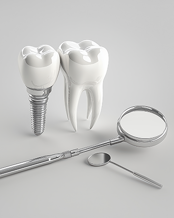 임플란트