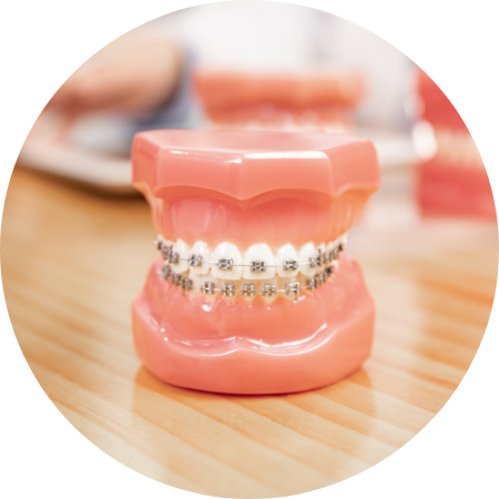 Dental Implant Process image2